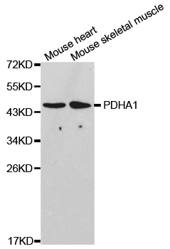 PDHA1 / PDH E1 Alpha Antibody - Western blot analysis of extracts of various cell lines.
