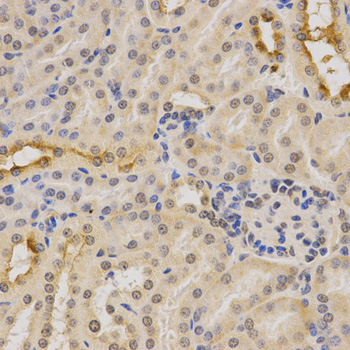 PDHA1 / PDH E1 Alpha Antibody - Immunohistochemistry of paraffin-embedded mouse kidney tissue.