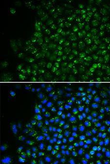 PDHA1 / PDH E1 Alpha Antibody - Immunofluorescence analysis of U2OS cells.