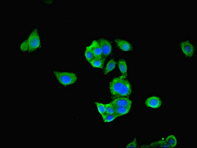 PDHA1 / PDH E1 Alpha Antibody - Immunofluorescent analysis of PC-3 cells using PDHA1 Antibody at dilution of 1:100 and Alexa Fluor 488-congugated AffiniPure Goat Anti-Rabbit IgG(H+L)