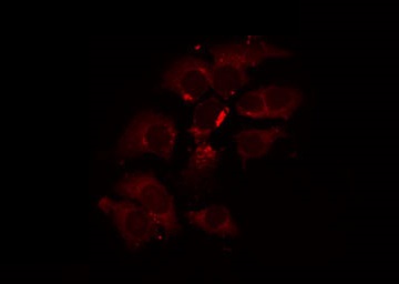 PDHA1 / PDH E1 Alpha Antibody - Staining A549 cells by IF/ICC. The samples were fixed with PFA and permeabilized in 0.1% Triton X-100, then blocked in 10% serum for 45 min at 25°C. The primary antibody was diluted at 1:200 and incubated with the sample for 1 hour at 37°C. An Alexa Fluor 594 conjugated goat anti-rabbit IgG (H+L) Ab, diluted at 1/600, was used as the secondary antibody.