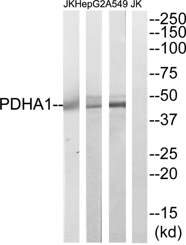 PDHA1 / PDH E1 Alpha Antibody - Western blot analysis of extracts from A549, HepG2 and Jurkat cells, using PDHA1 antibody.