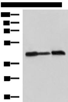 PDHA1 / PDH E1 Alpha Antibody - Western blot analysis of A549 Hela and HepG2 cell lysates  using PDHA1 Polyclonal Antibody at dilution of 1:750