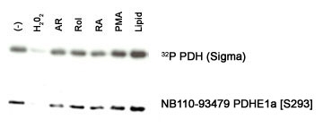 PDHA1 / PDH E1 Alpha Antibody - Pyruvate Dehydrogenase E1 alpha Phosphospecific Antibody - Detection of PDHE1 alpha [S293] in an in vitro autophosphorylation of PDH complex in response to different stimulants: (-) none, H202-hydrogen peroxide, AR-anhydroretinol, Rol-retinol, RA-retinoic acid, PMA, Lipid-PKC lipid activator.  This image was taken for the unconjugated form of this product. Other forms have not been tested.