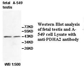 PDHA2 / PDH E1 Beta Antibody