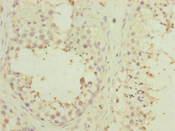 PDHA2 / PDH E1 Beta Antibody - Immunohistochemistry of paraffin-embedded human testis tissue at dilution of 1:100