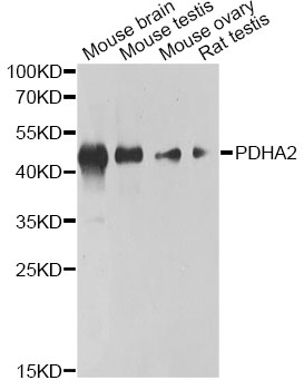 PDHA2 / PDH E1 Beta Antibody - Western blot analysis of extracts of various cell lines, using PDHA2 antibody at 1:1000 dilution. The secondary antibody used was an HRP Goat Anti-Rabbit IgG (H+L) at 1:10000 dilution. Lysates were loaded 25ug per lane and 3% nonfat dry milk in TBST was used for blocking. An ECL Kit was used for detection and the exposure time was 60s.