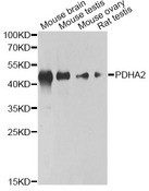 PDHA2 / PDH E1 Beta Antibody - Western blot analysis of extracts of various cell lines, using PDHA2 antibody at 1:1000 dilution. The secondary antibody used was an HRP Goat Anti-Rabbit IgG (H+L) at 1:10000 dilution. Lysates were loaded 25ug per lane and 3% nonfat dry milk in TBST was used for blocking. An ECL Kit was used for detection and the exposure time was 60s.