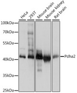 PDHA2 / PDH E1 Beta Antibody - Western blot analysis of extracts of various cell lines, using Pdha2 antibody at 1:1000 dilution. The secondary antibody used was an HRP Goat Anti-Rabbit IgG (H+L) at 1:10000 dilution. Lysates were loaded 25ug per lane and 3% nonfat dry milk in TBST was used for blocking. An ECL Kit was used for detection and the exposure time was 1s.