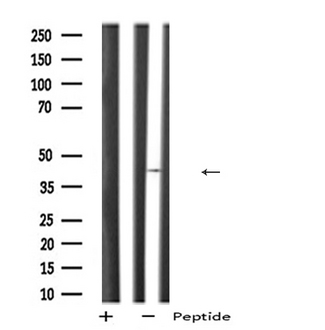 PDHA2 / PDH E1 Beta Antibody - Western blot analysis of PDHA2 expression in NCI-H460 cells line lysates. The lane on the left is treated with the antigen-specific peptide.