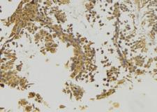PDHA2 / PDH E1 Beta Antibody - 1:100 staining rat testis tissue by IHC-P. The sample was formaldehyde fixed and a heat mediated antigen retrieval step in citrate buffer was performed. The sample was then blocked and incubated with the antibody for 1.5 hours at 22°C. An HRP conjugated goat anti-rabbit antibody was used as the secondary.