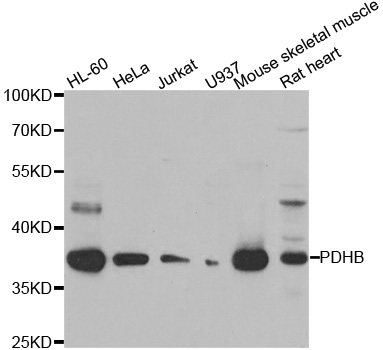 PDHB Antibody - Western blot analysis of extracts of various cell lines.