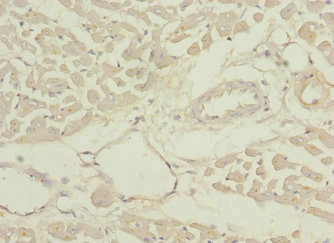 PDHB Antibody - Immunohistochemistry of paraffin-embedded human heart tissue at dilution 1:100