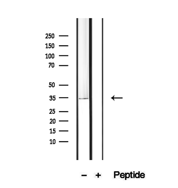 PDHB Antibody - Western blot analysis of extracts of K562 cells using PDHB antibody.
