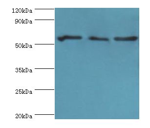 PDHX / Protein X / ProX Antibody - Western blot. All lanes: PDHX antibody at 6 ug/ml. Lane 1: 293T whole cell lysate. Lane 2: PC-3 whole cell lysate. Lane 3: MCF-7 whole cell lysate. Secondary antibody: Goat polyclonal to rabbit at 1:10000 dilution. Predicted band size: 54 kDa. Observed band size: 54 kDa Immunohistochemistry.