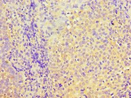 PDHX / Protein X / ProX Antibody - Immunohistochemistry of paraffin-embedded human tonsil using antibody at 1:100 dilution.