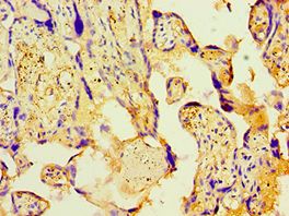 PDHX / Protein X / ProX Antibody - Immunohistochemistry of paraffin-embedded human placenta using antibody at 1:100 dilution.