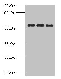 PDHX / Protein X / ProX Antibody - Western blot All lanes: PDHX antibody at 6µg/ml Lane 1: 293T whole cell lysate Lane 2: PC-3 whole cell lysate Lane 3: MCF-7 whole cell lysate Secondary Goat polyclonal to rabbit IgG at 1/10000 dilution Predicted band size: 55, 30, 52 kDa Observed band size: 55 kDa