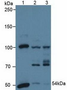 PDHX / Protein X / ProX Antibody - Western Blot; Sample: Lane1: Human A431 Cells; Lane2: Human Hela Cells; Lane3: Porcine Heart Tissue.