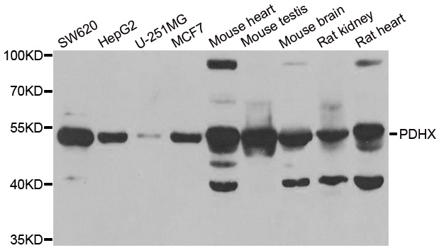 PDHX / Protein X / ProX Antibody - Western blot analysis of extracts of various cell lines.