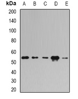 PDHX / Protein X / ProX Antibody - Western blot analysis of E3BP expression in HepG2 (A); MCF7 (B); mouse testis (C); mouse brain (D); rat kidney (E) whole cell lysates.