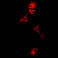 PDHX / Protein X / ProX Antibody - Immunofluorescent analysis of E3BP staining in U2OS cells. Formalin-fixed cells were permeabilized with 0.1% Triton X-100 in TBS for 5-10 minutes and blocked with 3% BSA-PBS for 30 minutes at room temperature. Cells were probed with the primary antibody in 3% BSA-PBS and incubated overnight at 4 deg C in a humidified chamber. Cells were washed with PBST and incubated with a DyLight 594-conjugated secondary antibody (red) in PBS at room temperature in the dark.