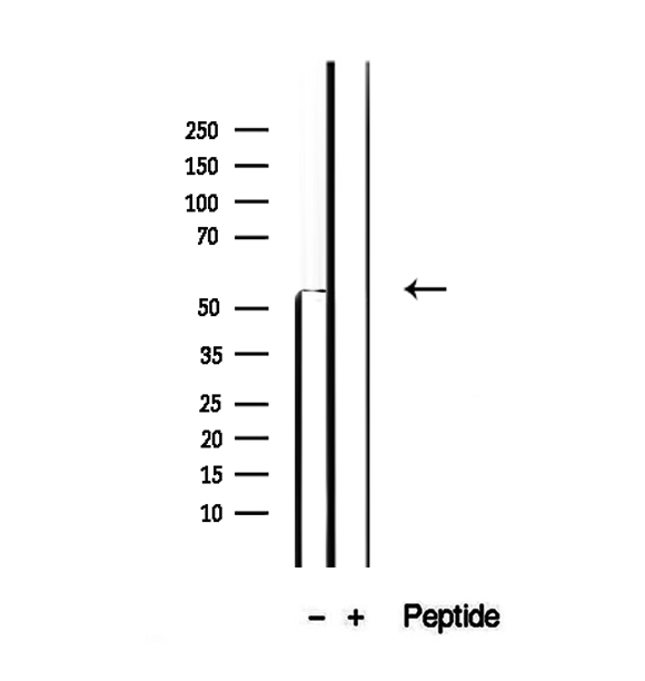 PDHX / Protein X / ProX Antibody - Western blot analysis of extracts of SK-OV3 cells using PDHX antibody.