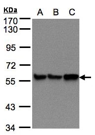 PDI / P4HB Antibody - Sample (30 ug of whole cell lysate). A:293T, B: A431, C: H1299. 7.5% SDS PAGE. PDI / P4HB antibody diluted at 1:500