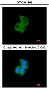 PDI / P4HB Antibody - Immunofluorescence of methanol-fixed A431 using PDI antibody at 1:200 dilution.
