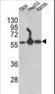 PDI / P4HB Antibody - Western blot of P4HB Antibody in CEM,HepG2,A2058 cell line lysates (35 ug/lane). P4HB (arrow) was detected using the purified antibody.(2 ug/ml)