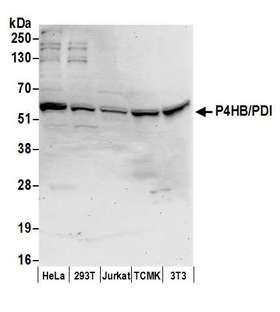 PDI / P4HB Antibody - Detection of human and mouse P4HB/PDI by western blot. Samples: Whole cell lysate (50 µg) from HeLa, HEK293T, Jurkat, mouse TCMK-1, and mouse NIH 3T3 cells prepared using NETN lysis buffer. Antibody: Affinity purified rabbit anti-P4HB/PDI antibody used for WB at 0.1 µg/ml. Detection: Chemiluminescence with an exposure time of 30 seconds.