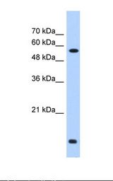 PDI / P4HB Antibody - HepG2 cell lysate. Antibody concentration: 0.25 ug/ml. Gel concentration: 12%.  This image was taken for the unconjugated form of this product. Other forms have not been tested.