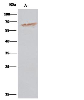 PDI / P4HB Antibody - P4HB was immunoprecipitated using: Lane A: 0.5 mg MCF-7 Whole Cell Lysate. 2 uL anti-P4HB rabbit monoclonal antibody and 15 ul of 50% Protein G agarose. Primary antibody: Anti-P4HB rabbit monoclonal antibody, at 1:200 dilution. Secondary antibody: Clean-Blot IP Detection Reagent (HRP) at 1:1000 dilution. Developed using the DAB staining technique. Performed under reducing conditions. Predicted band size: 57 kDa. Observed band size: 57 kDa.