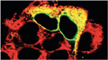 PDI / P4HB Antibody - Immunohistochemistry of human HEK293 cells transfected with wild type TorsinA co-stained with PDI monoclonal antibody (1D3) (red). Co-localization of TorsinA and PDI proteins merge as yellow.
