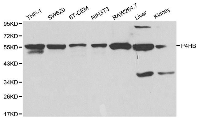 PDI / P4HB Antibody - Western blot of P4HB pAb in extracts from THP-1, SW620, 6T-CEM, NIH3T3, RAW264.7 cells and mouse liver, kidney tissues.