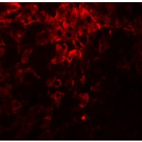 PDI / P4HB Antibody - Immunofluorescence of PDIA1 in rat small intestine tissue with PDIA1 antibody at 20 µg/mL.