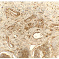 PDI / P4HB Antibody - Immunohistochemistry of PDIA1 in rat small intestine tissue with PDIA1 antibody at 5 µg/mL.