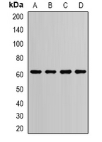 PDI / P4HB Antibody - Western blot analysis of PDI expression in THP1 (A); SW620 (B); NIH3T3 (C); mouse liver (D) whole cell lysates.