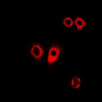 PDI / P4HB Antibody - Immunofluorescent analysis of PDI staining in HeLa cells. Formalin-fixed cells were permeabilized with 0.1% Triton X-100 in TBS for 5-10 minutes and blocked with 3% BSA-PBS for 30 minutes at room temperature. Cells were probed with the primary antibody in 3% BSA-PBS and incubated overnight at 4 deg C in a humidified chamber. Cells were washed with PBST and incubated with a DyLight 594-conjugated secondary antibody (red) in PBS at room temperature in the dark.