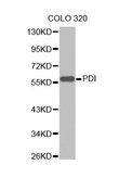 PDI / P4HB Antibody - Western blot analysis of extracts of COLO320 cells, using P4HB antibody. The secondary antibody used was an HRP Goat Anti-Rabbit IgG (H+L) at 1:10000 dilution. Lysates were loaded 25ug per lane and 3% nonfat dry milk in TBST was used for blocking.