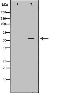 PDI / P4HB Antibody - Western blot analysis of mouse liver tissue lysates using P4HB antibody. The lane on the left is treated with the antigen-specific peptide.