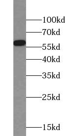 PDI / P4HB Antibody - HEK-293 cells were subjected to SDS PAGE followed by western blot with PDI antibody at dilution of 1:50000