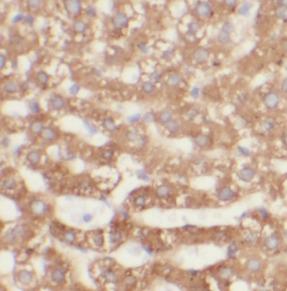 PDI / P4HB Antibody - Immunohistochemistry of paraffin-embedded human liver tissue slide using PDI antibody at dilution of 1:200