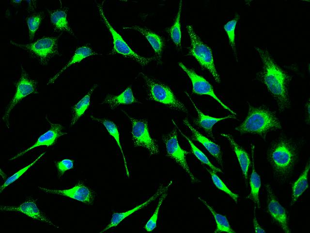 PDI / P4HB Antibody - Immunofluorescence staining of P4HB in Hela cells. Cells were fixed with 4% PFA, permeabilzed with 0.1% Triton X-100 in PBS, blocked with 10% serum, and incubated with rabbit anti-Human P4HB polyclonal antibody (dilution ratio 1:1000) at 4°C overnight. Then cells were stained with the Alexa Fluor 488-conjugated Goat Anti-rabbit IgG secondary antibody (green) and counterstained with DAPI (blue). Positive staining was localized to Cytoplasm.