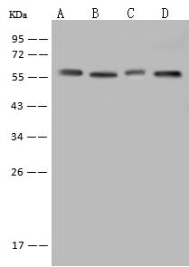 PDI / P4HB Antibody - Anti-P4HB rabbit polyclonal antibody at 1:1000 dilution. Lane A: HepG2 Whole Cell Lysate. Lane B: HeLa Whole Cell Lysate. Lane C: 293T Whole Cell Lysate. Lane D: A431 Whole Cell Lysate. Lysates/proteins at 30 ug per lane. Secondary: Goat Anti-Rabbit IgG (H+L)/HRP at 1/10000 dilution. Developed using the ECL technique. Performed under reducing conditions. Predicted band size: 57 kDa. Observed band size: 57 kDa.