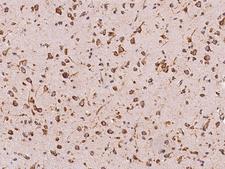 PDI / P4HB Antibody - Immunochemical staining of human P4HB in human brain with rabbit polyclonal antibody at 1:1000 dilution, formalin-fixed paraffin embedded sections.