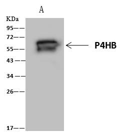 PDI / P4HB Antibody - P4HB was immunoprecipitated using: Lane A: 0.5 mg HepG2 Whole Cell Lysate. 4 uL anti-P4HB rabbit polyclonal antibody and 60 ug of Immunomagnetic beads Protein A/G. Primary antibody: Anti-P4HB rabbit polyclonal antibody, at 1:100 dilution. Secondary antibody: Clean-Blot IP Detection Reagent (HRP) at 1:1000 dilution. Developed using the ECL technique. Performed under reducing conditions. Predicted band size: 57 kDa. Observed band size: 57 kDa.