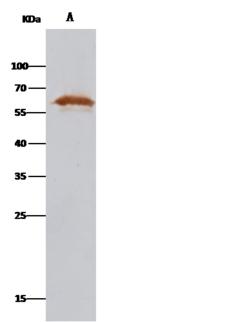 PDI / P4HB Antibody - P4HB was immunoprecipitated using: Lane A: 0.5 mg MCF-7 Whole Cell Lysate. 2 uL anti-P4HB rabbit polyclonal antibody and 15 ul of 50% Protein G agarose. Primary antibody: Anti-P4HB rabbit polyclonal antibody, at 1:1000 dilution. Secondary antibody: Clean-Blot IP Detection Reagent (HRP) at 1:1000 dilution. Developed using the DAB staining technique. Performed under reducing conditions. Predicted band size: 57 kDa. Observed band size: 57 kDa.