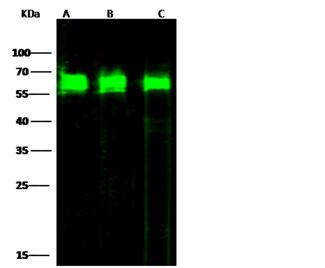 PDI / P4HB Antibody - Anti-P4HB rabbit polyclonal antibody at 1:1000 dilution. Lane A: A431 Whole Cell Lysate. Lane B: RAW264.7 Whole Cell Lysate. Lane C: MCF7 Whole Cell Lysate. Lysates/proteins at 30 ug per lane. Secondary: Goat Anti-Rabbit IgG H&L (Dylight800) at 1/10000 dilution. Developed using the Odyssey technique. Performed under reducing conditions. Predicted band size: 56 kDa. Observed band size: 60 kDa.