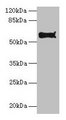 PDIA2 Antibody - Western blot All lanes: Protein disulfide-isomerase A2 antibody at 10µg/ml + Hela whole cell lysate Secondary Goat polyclonal to rabbit IgG at 1/10000 dilution Predicted band size: 59, 58 kDa Observed band size: 59 kDa